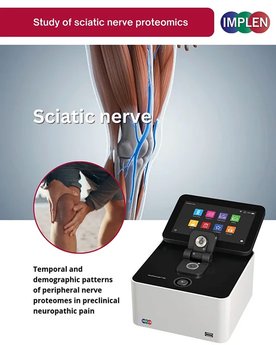 Implen Journal Club proteome dynamics after sciatic nerve injury